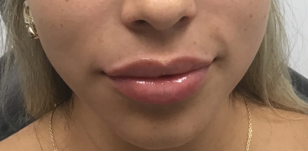 After