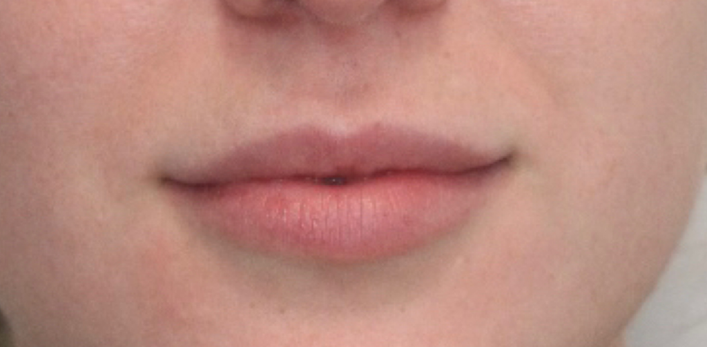 Before