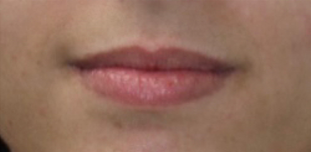 Before