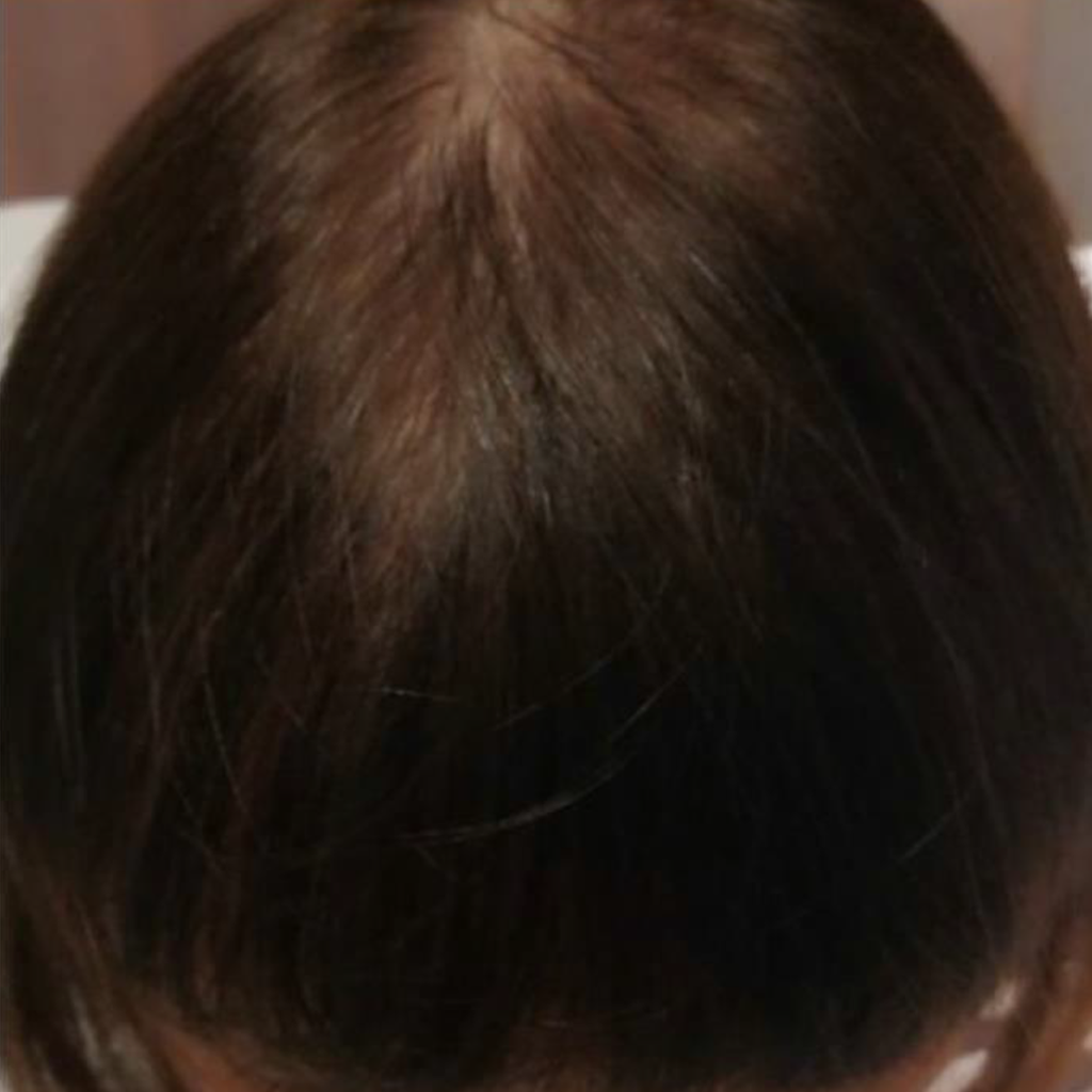 After