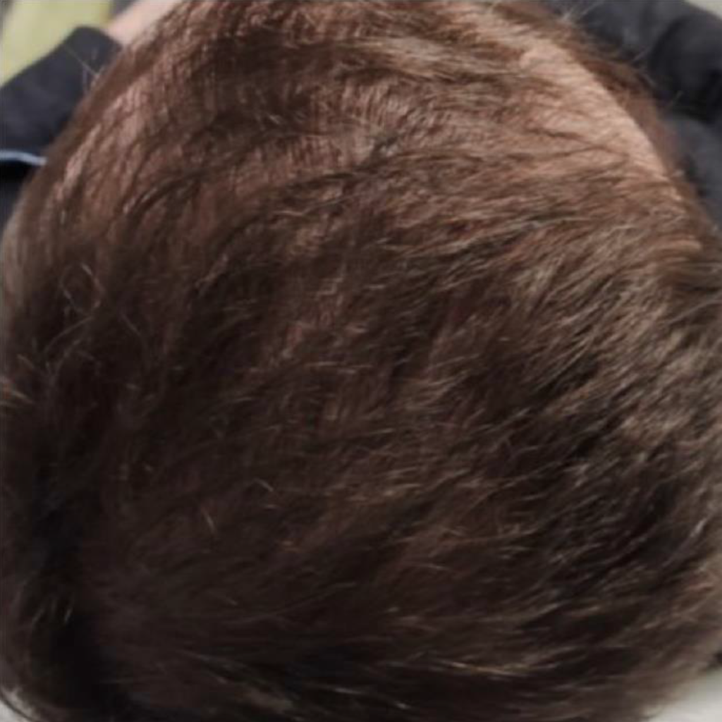 After