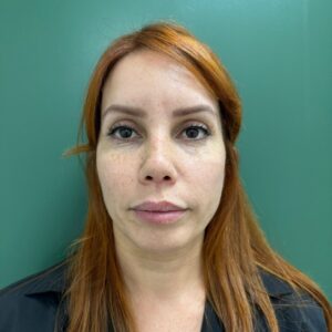 Before - Patient 2