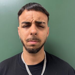 Before - Patient 1