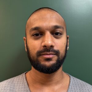 Before - Patient 3