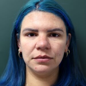 Before - Patient  3
