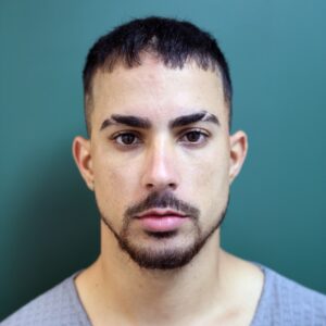 Before - Patient 1