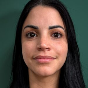 Before - Patient 4