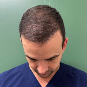 After - Patient 1